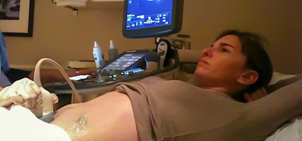 Pregnancy Care, pregnant woman getting an ultrasound