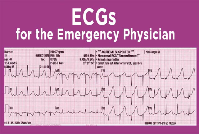 ECGs for the Emergency Physician